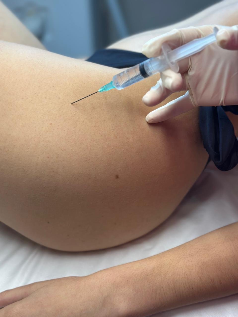 Ενέσιμη Λιποδιάλυση